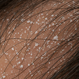 Lo que no sabias de la CASPA